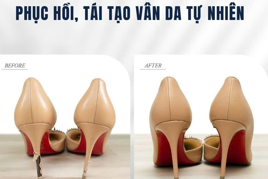 Phục hồi vân da tự nhiên giày cao gót, ảnh trước và sau