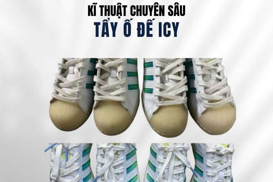Tẩy ố vàng đế icy giày Adidas